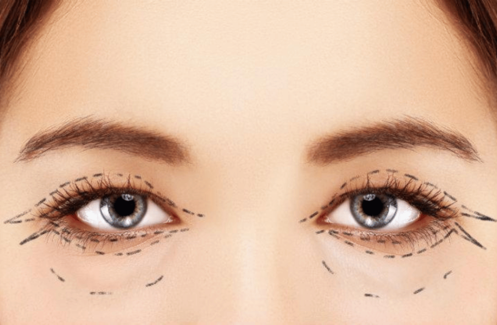 Eye image representing cosmetic eye surgery to improve aesthetic appearance and address aging signs.