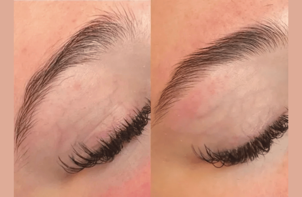 A comparison image showing the results of eyelash and eyebrow rejuvenation procedures for enhanced cosmetic appearance.