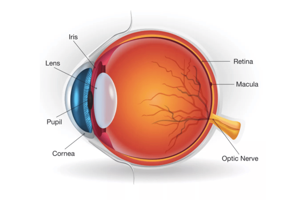 Illustration of an eye affected by retinal vein occlusion, highlighting blocked blood flow in the retinal veins.