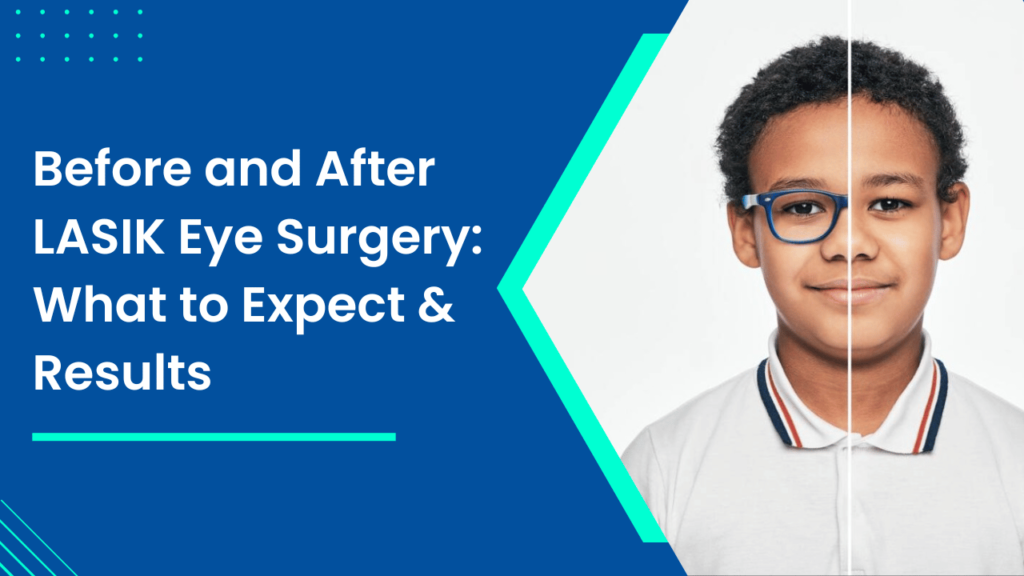 Before and After LASIK Eye Surgery_ What to Expect & Results