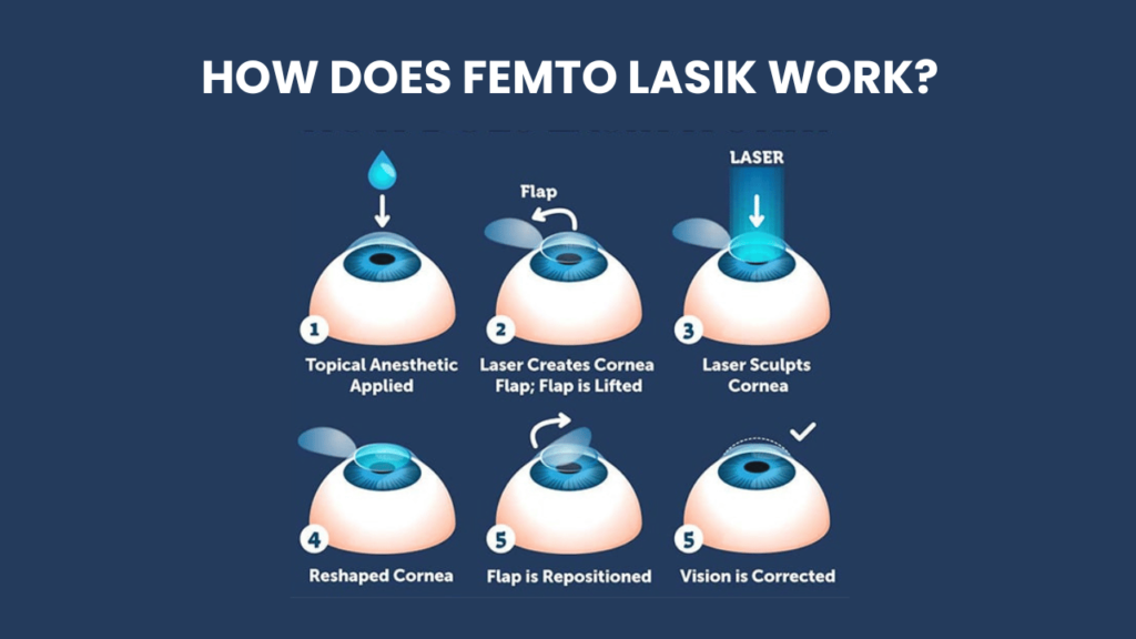 What is Femto LASIK Surgery