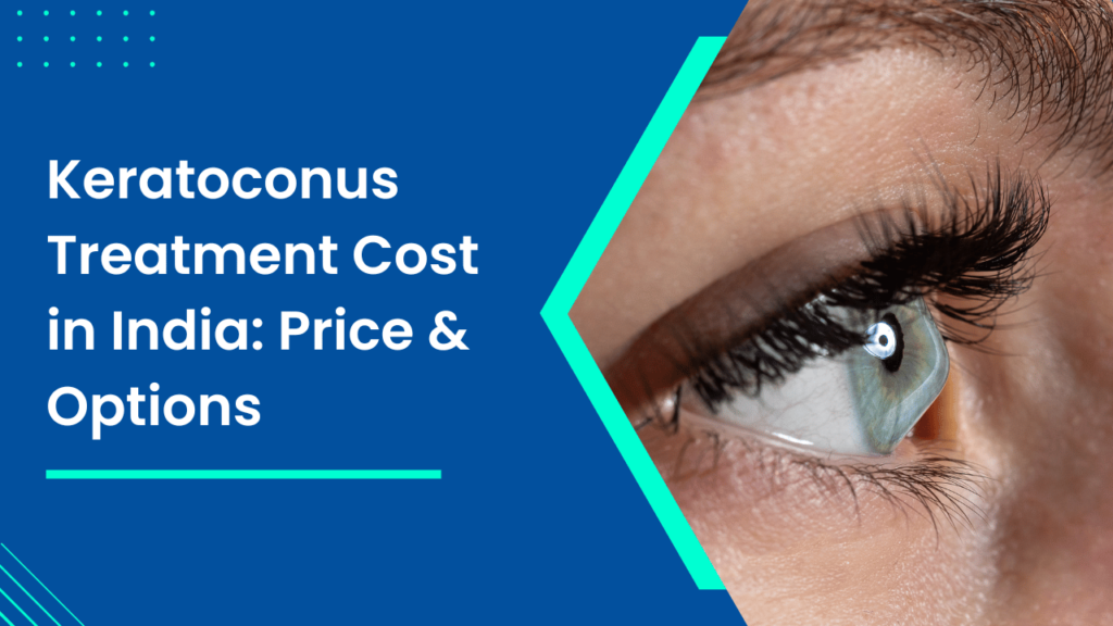 Keratoconus Treatment Cost in India Price & Options