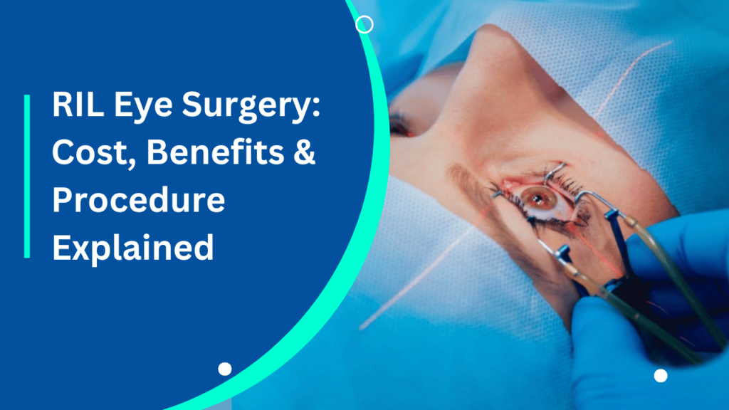 RIL Eye Surgery_ Cost, Benefits & Procedure Explained